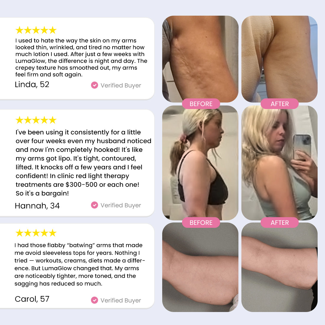 LumaGlow 7-in-1 LED Arm Sculptor