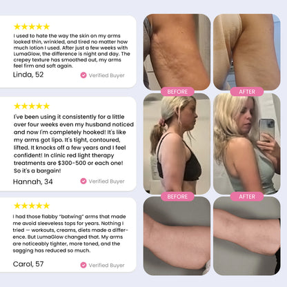 LumaGlow 7-in-1 LED Arm Sculptor