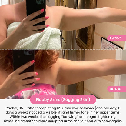 LumaGlow 7-in-1 LED Arm Sculptor