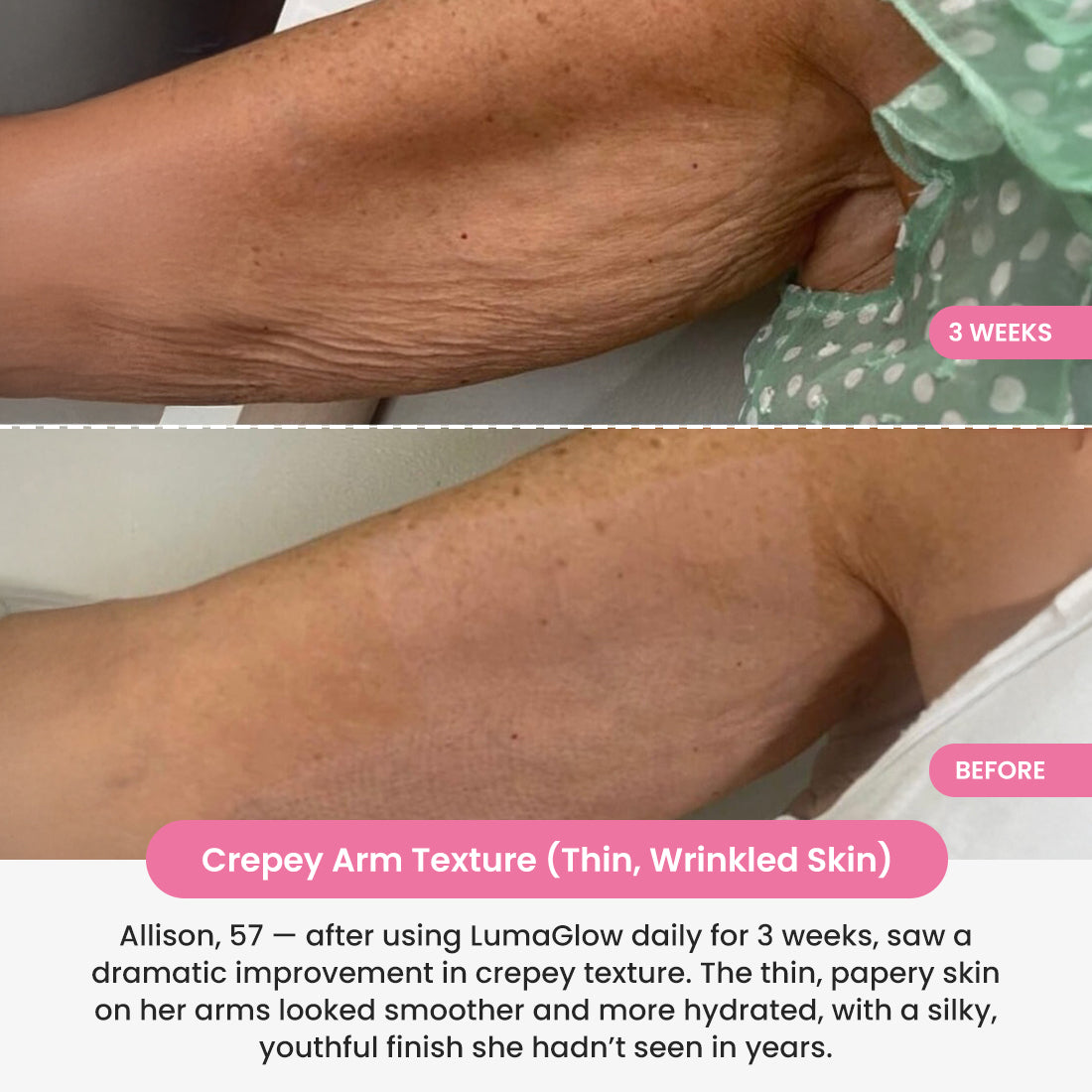 LumaGlow 7-in-1 LED Arm Sculptor