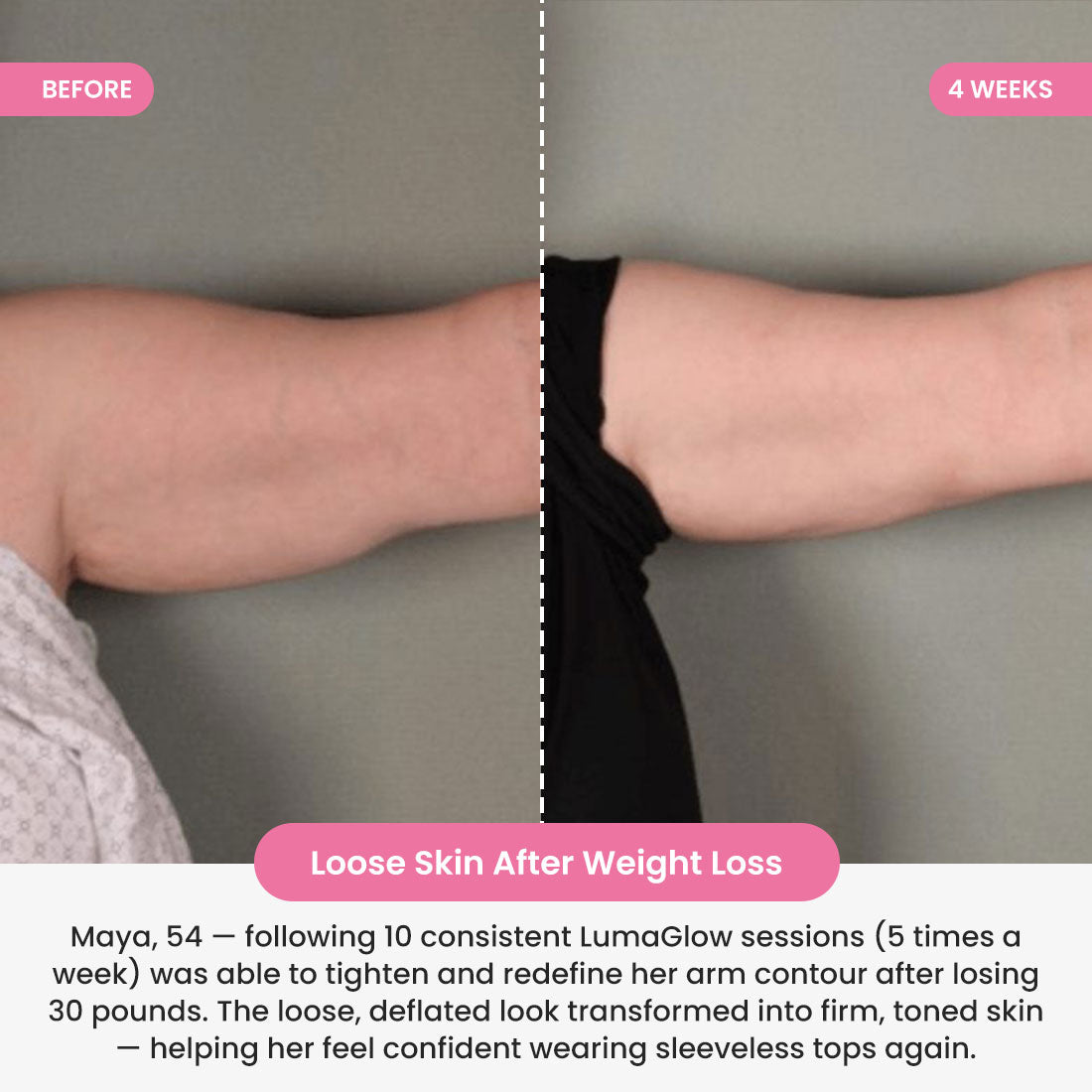 LumaGlow 7-in-1 LED Arm Sculptor