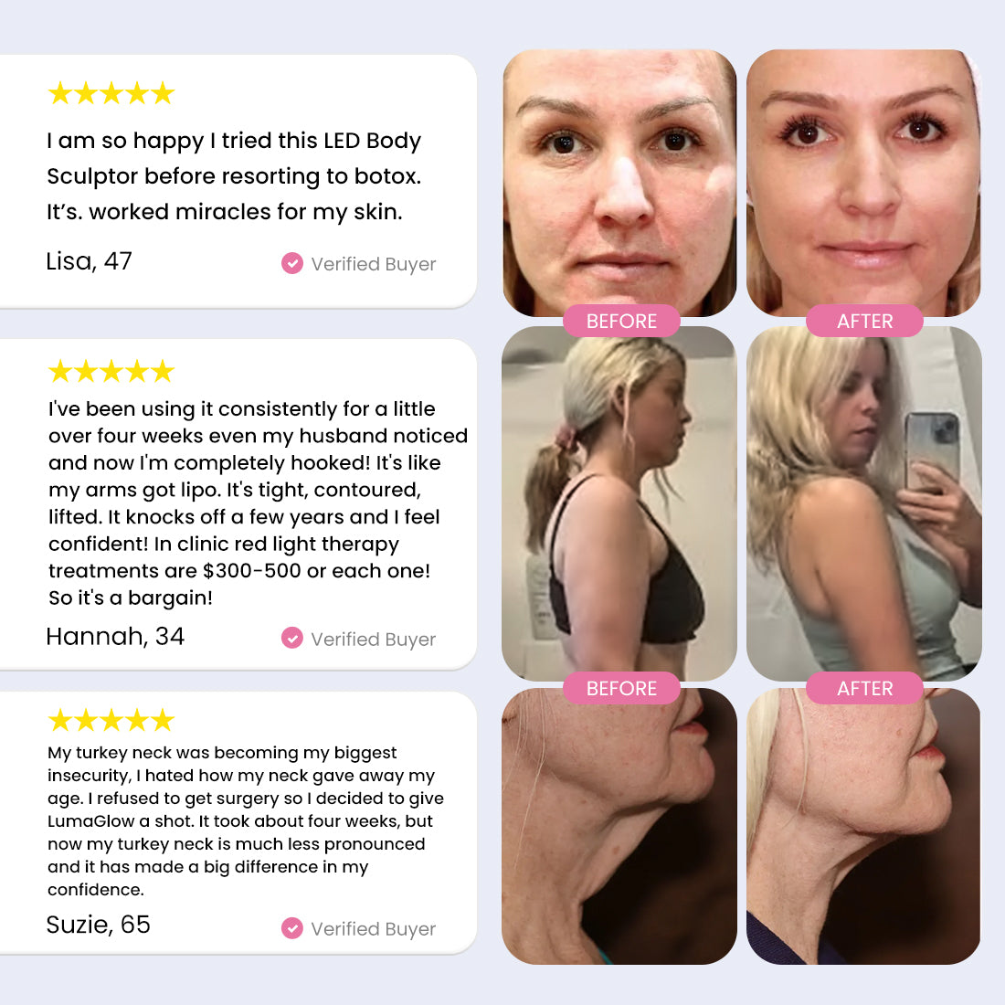 LumaGlow 7-in-1 LED Body Sculptor & Serums Kit