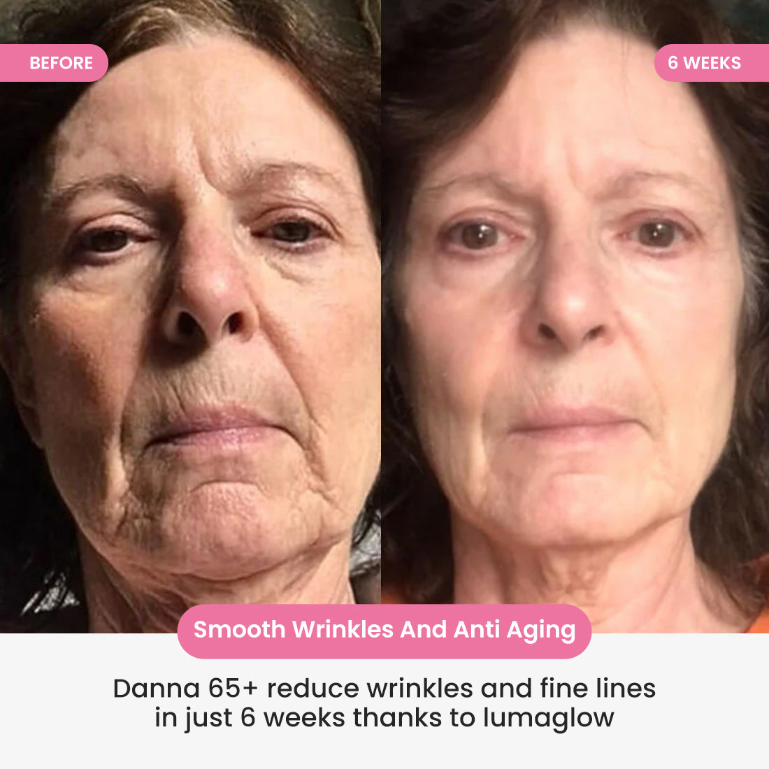 LumaGlow 7-in-1 LED Face & Neck Sculptor