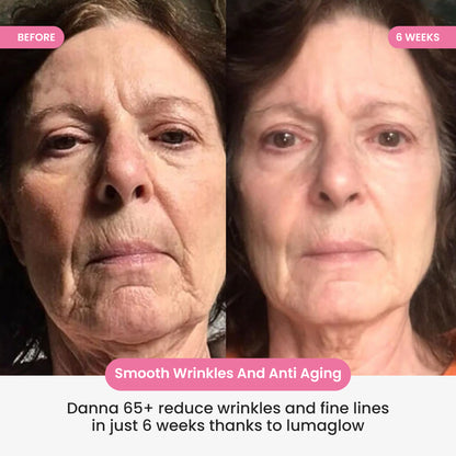 LumaGlow 7-in-1 LED Face & Neck Sculptor