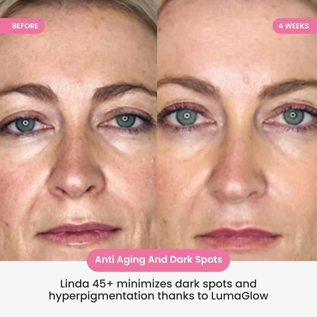 LumaGlow 7-in-1 LED Face & Neck Sculptor