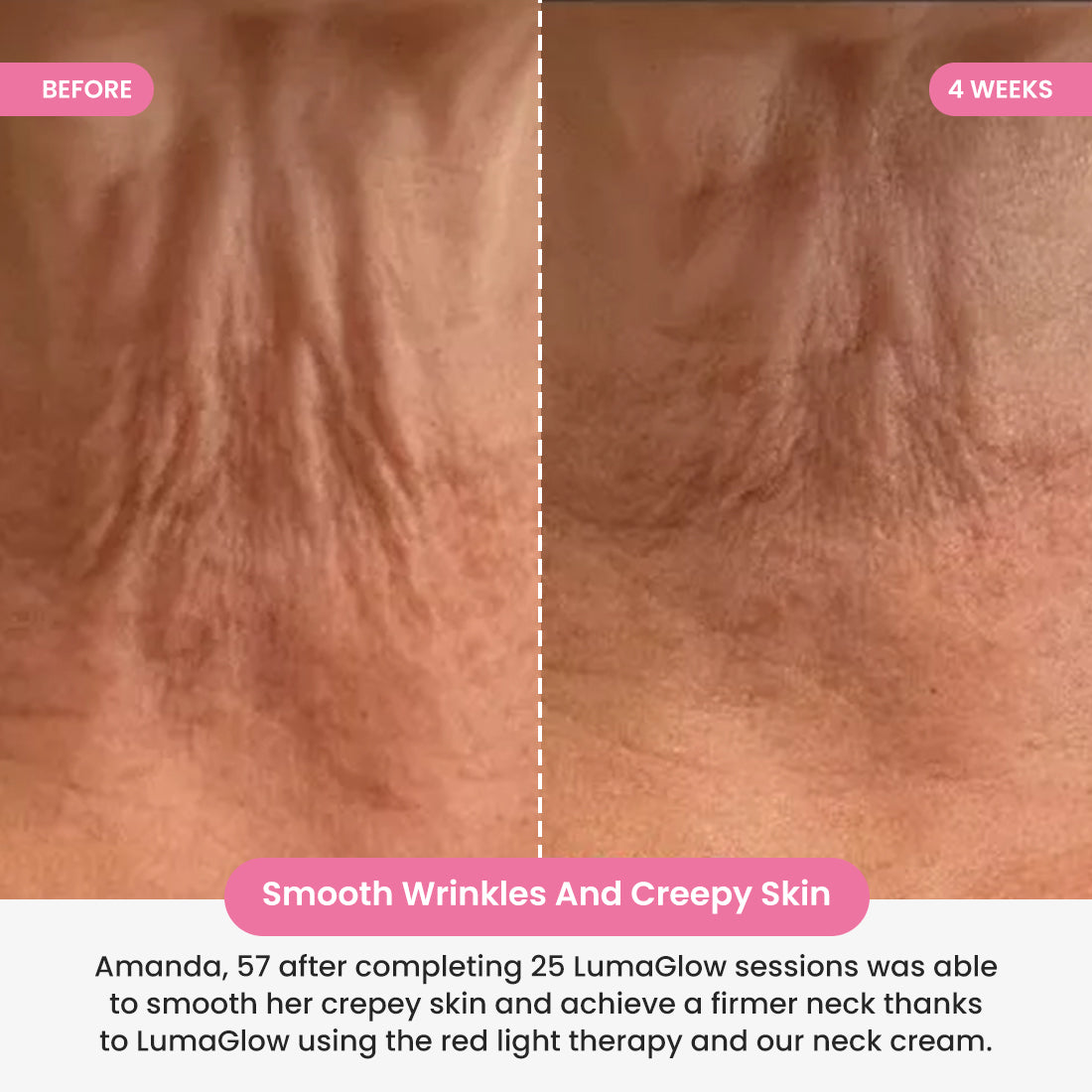 LumaGlow 7-in-1 LED Neck Lifter