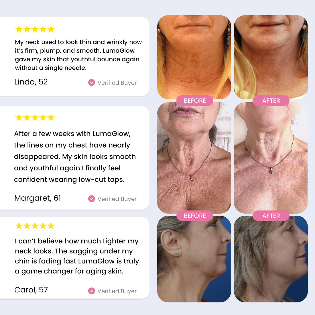 LumaGlow 7-in-1 LED Neck Lifter