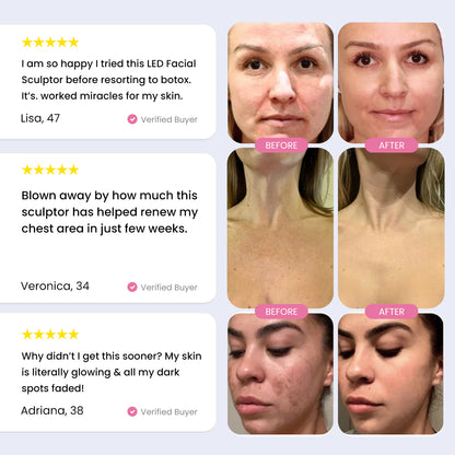 LumaGlow 7-in-1 LED Face & Neck Sculptor